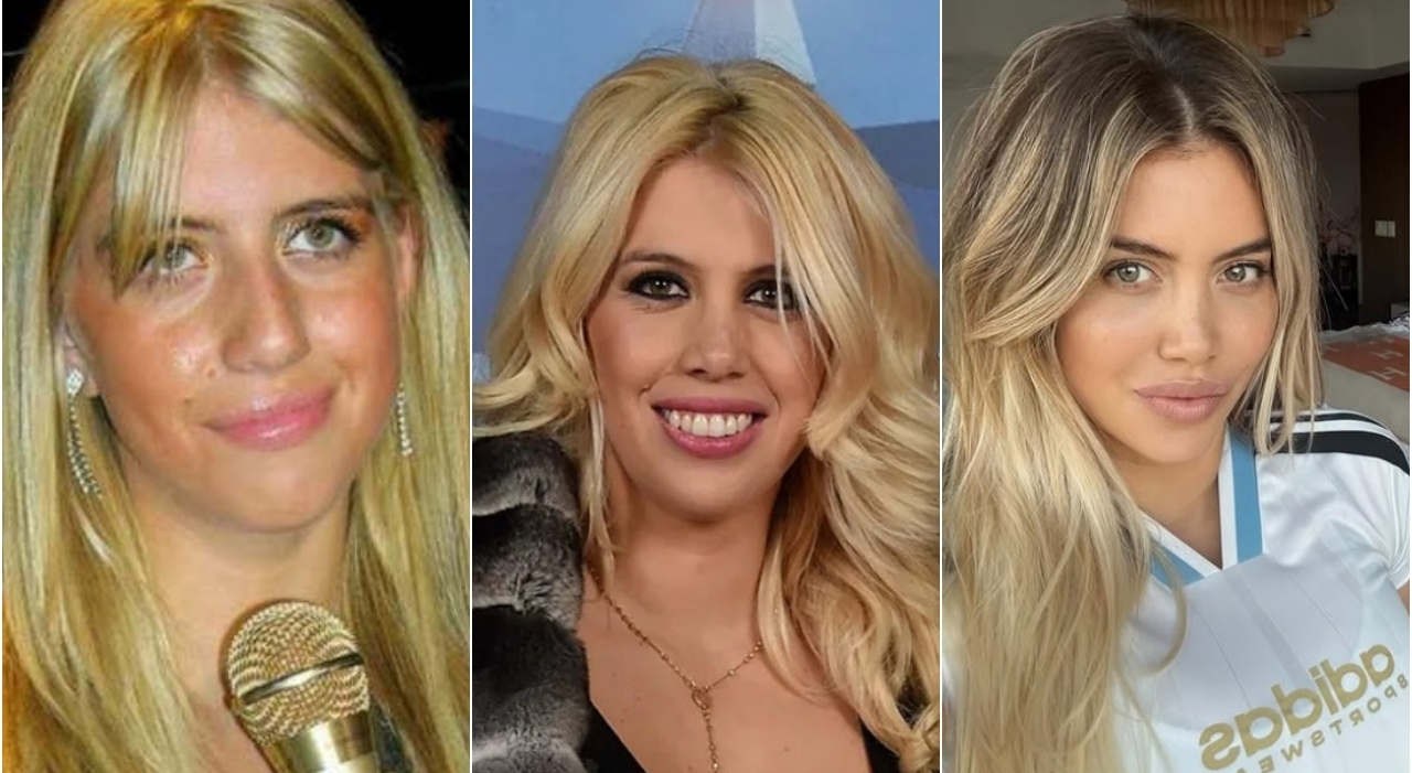 Wanda Nara prima e dopo: i denti sporgenti, il ritocchino al naso, il seno ridotto: «Dermolipectomia per rimuovere grasso e pelle in eccesso» Wanda Nara prima e dopo: i denti sporgenti, il ritocchino al naso, il seno ridotto: «Dermolipectomia per rimuovere grasso e pelle in eccesso»