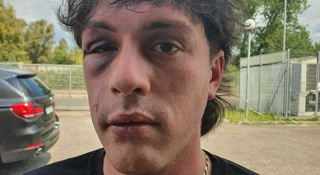 Un gesto inaspettato per proteggere una ragazza dalle molestie di un gruppo
