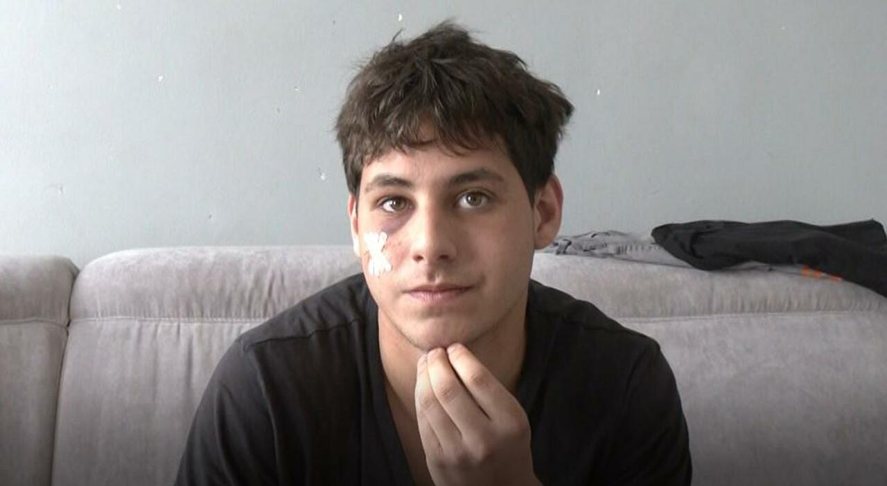 Kevin, maggiorenne da un mese, picchiato nel buio dalla baby gang: «Temevo di morire» Kevin, maggiorenne da un mese, picchiato nel buio dalla baby gang: «Temevo di morire»