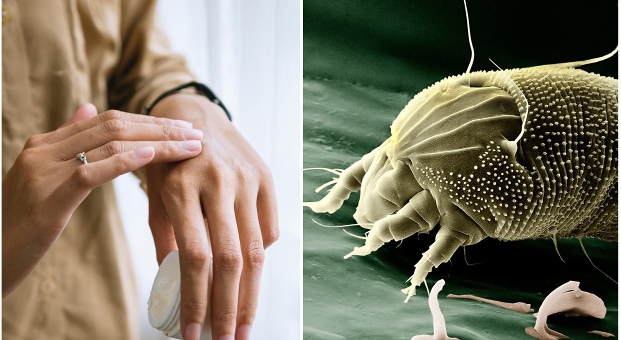 Allergie estive: come riconoscerle (e quando preoccuparsi). Sintomi, cause e rimedi