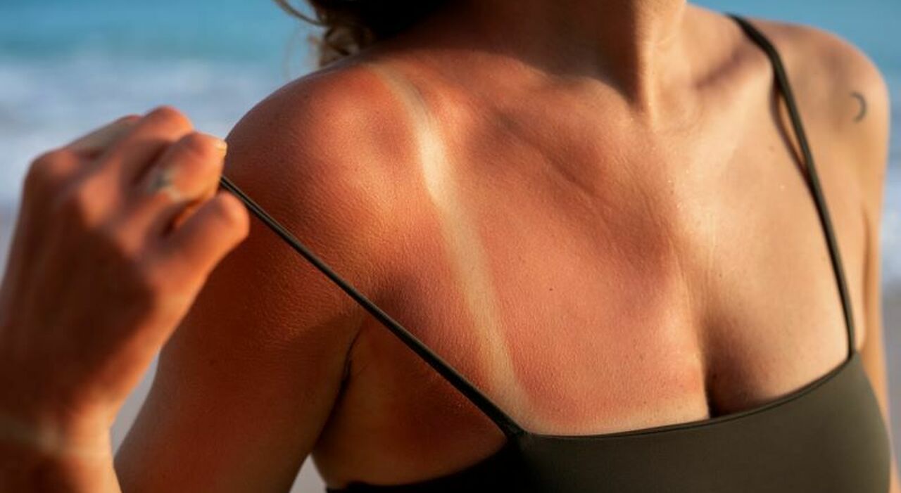 Pelle e abbronzatura: 5 falsi miti da sfatare secondo il dermatologo. «Esporsi al sole è un piacere, ma serve consapevolezza» Pelle e abbronzatura: 5 falsi miti da sfatare secondo il dermatologo. «Esporsi al sole è un piacere, ma serve consapevolezza»