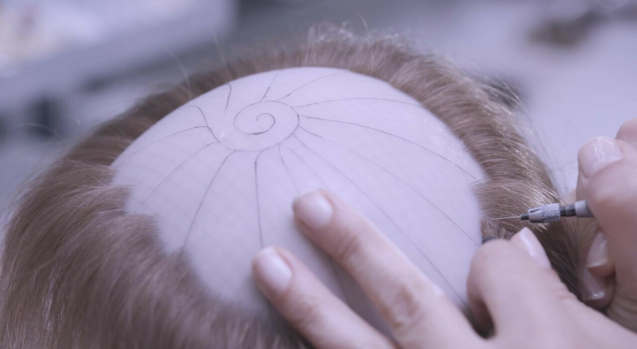 il tumore al seno a 28 anni la chemio i capelli persi la protesi mi ha restituito il sorriso ho ritrovato il coraggio di sognare