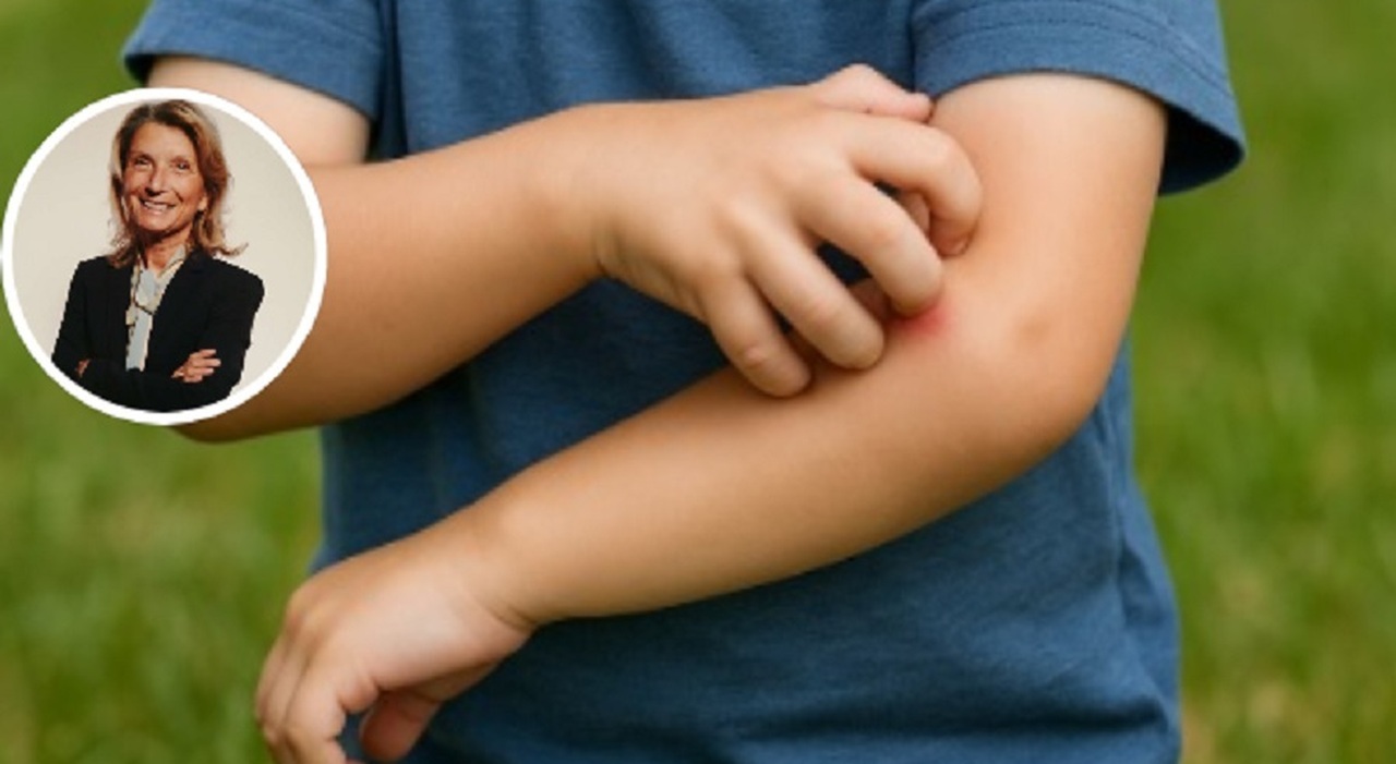 Zanzare, zecche, api, la pediatra: «Mai repellenti sotto i sei mesi, braccialetti inutili». Zanzariere, stick all Zanzare, zecche, api, la pediatra: «Mai repellenti sotto i sei mesi, braccialetti inutili». Zanzariere, stick all