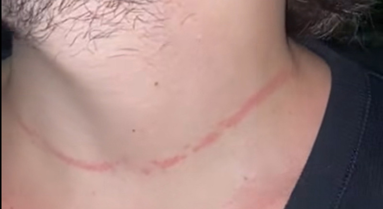 Napoli, furti al Piazza Village: «Gruppo di ragazzini mi ha strappato la collana, ferendomi» Napoli, furti al Piazza Village: «Gruppo di ragazzini mi ha strappato la collana, ferendomi»
