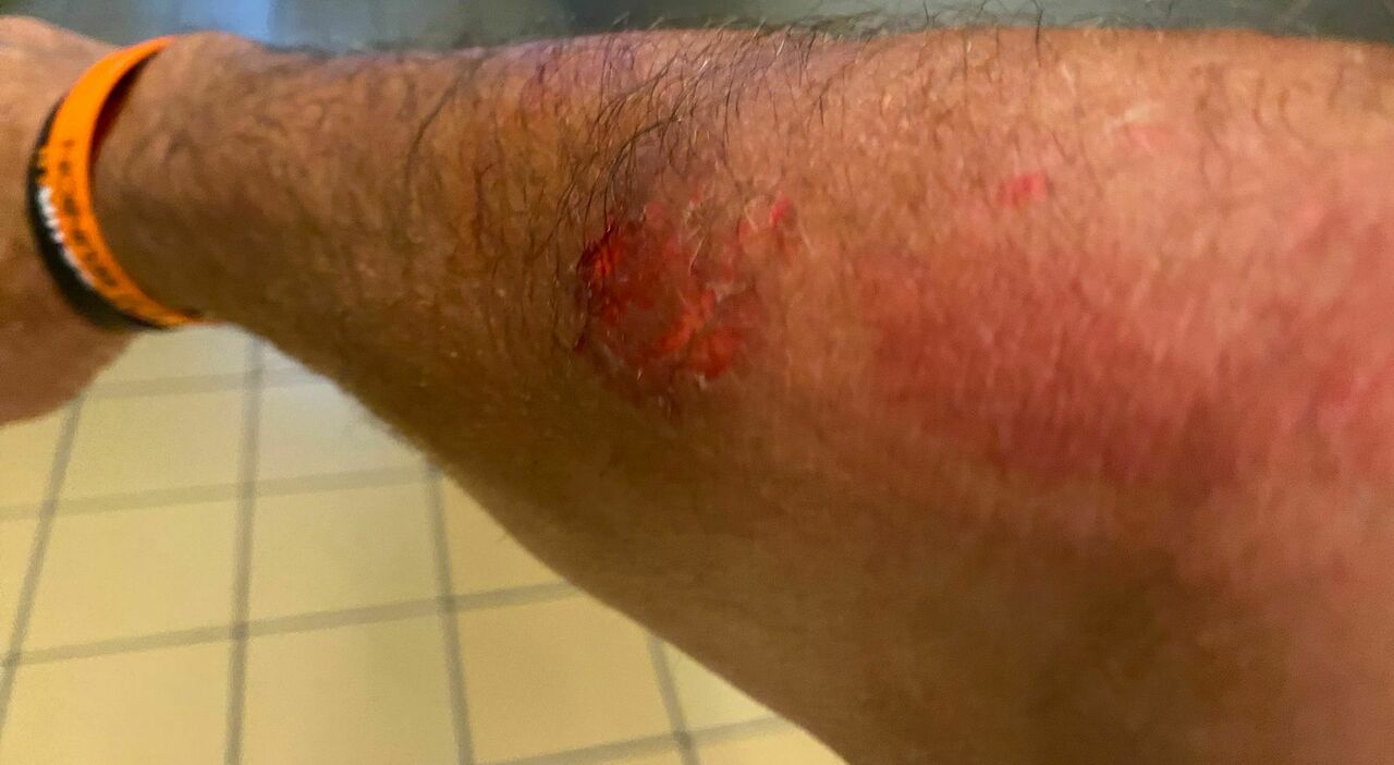 Caos in piscina, titolare blocca una 50enne durante una lite: «Lei mi ha morso e mi sono difeso. Ora vengo minacciato, denuncio tutti» Caos in piscina, titolare blocca una 50enne durante una lite: «Lei mi ha morso e mi sono difeso. Ora vengo minacciato, denuncio tutti»