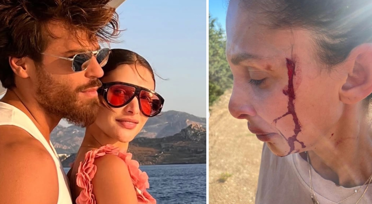 https://statics.cedscdn.it/photos/MED_HIGH/2025/07/19/8965967_19135042_sara_blame_can_yaman.jpg