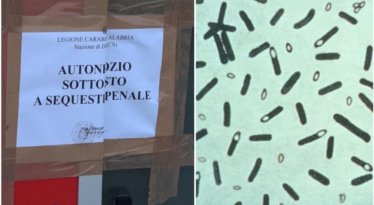 intossicati dal botulino a cosenza come sta chi ha ricevuto il siero anti tossina e perch233 lantidoto 232 una risorsa strategica nazionale