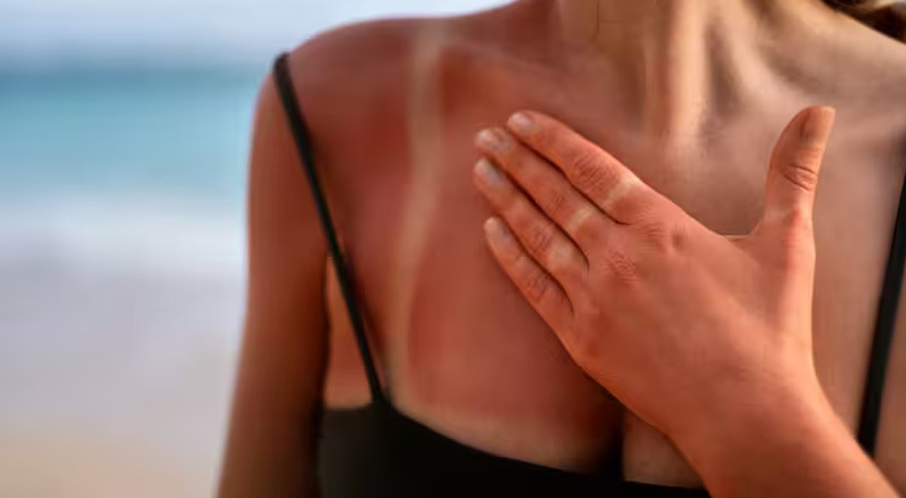 L'abbronzatura è ancora cool? Allarme per il trend social: ecco perché il Ministero della Salute lancia un campanello d'allarme e cosa fare per proteggersi
