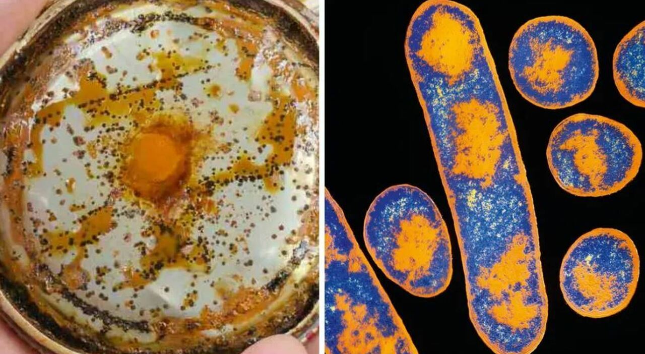 Botulino: i sintomi (della vista e gusto), il colore o l