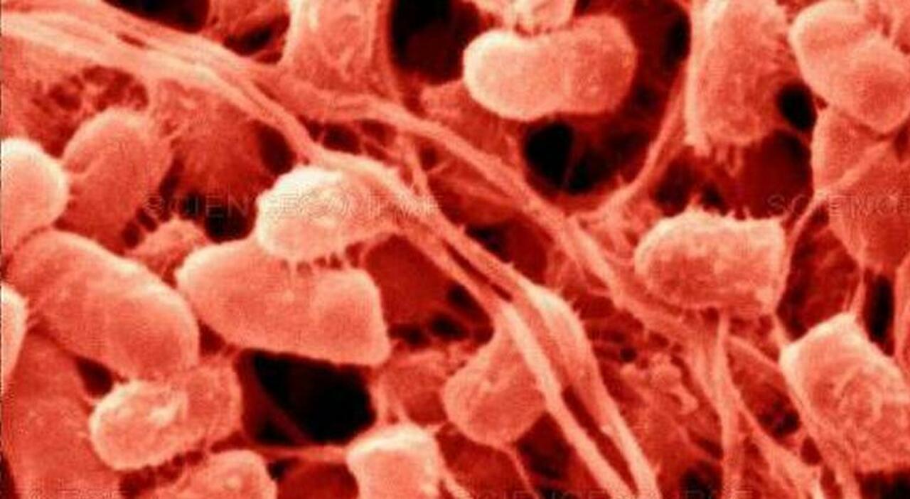 https://statics.cedscdn.it/photos/MED_HIGH/2025/08/14/9013184_14171744_serratia_marcescens_batterio_neonati_morti_cosa_e_oggi_14_8_2025.jpg