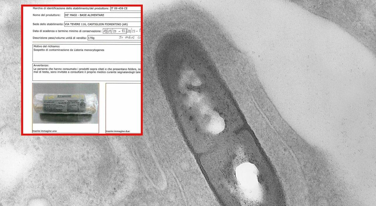 Listeriosi, prodotti ritirati in Italia per sospetta contaminazione: ecco quali sono. Sintomi, diagnosi e ...