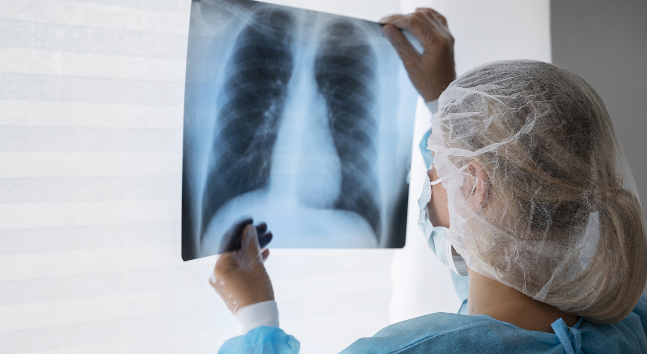 https://statics.cedscdn.it/photos/MED_HIGH/2025/08/19/9020087_19171505_radiografia_di_controllo_medico_di_vista_laterale.jpg