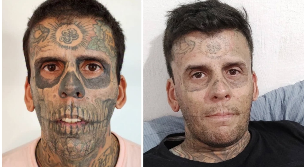 «Avevo il 95% del corpo ricoperto da tatuaggi: ero diventato un animale da circo. Così ho iniziato a rimuoverli ma è più doloroso che farli» «Avevo il 95% del corpo ricoperto da tatuaggi: ero diventato un animale da circo. Così ho iniziato a rimuoverli ma è più doloroso che farli»