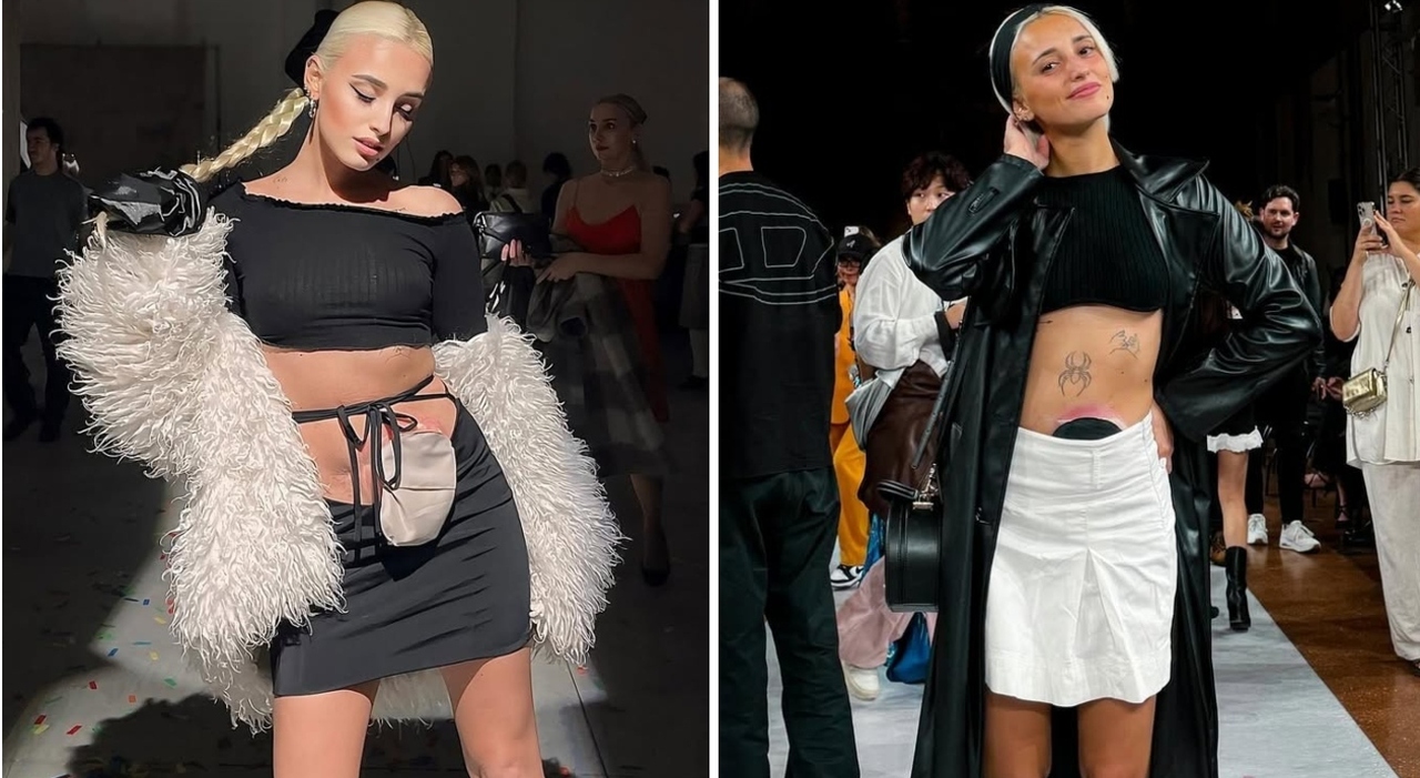 «Mi avevano dato 10 giorni di vita, oggi sono una modella e convivo con la stomia. Da TikTok al Parlamento europeo, parlo per chi non ha voce» «Mi avevano dato 10 giorni di vita, oggi sono una modella e convivo con la stomia. Da TikTok al Parlamento europeo, parlo per chi non ha voce»