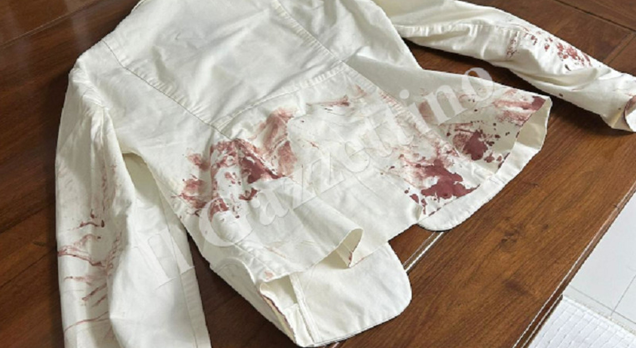Cameriera aggredita dall Cameriera aggredita dall
