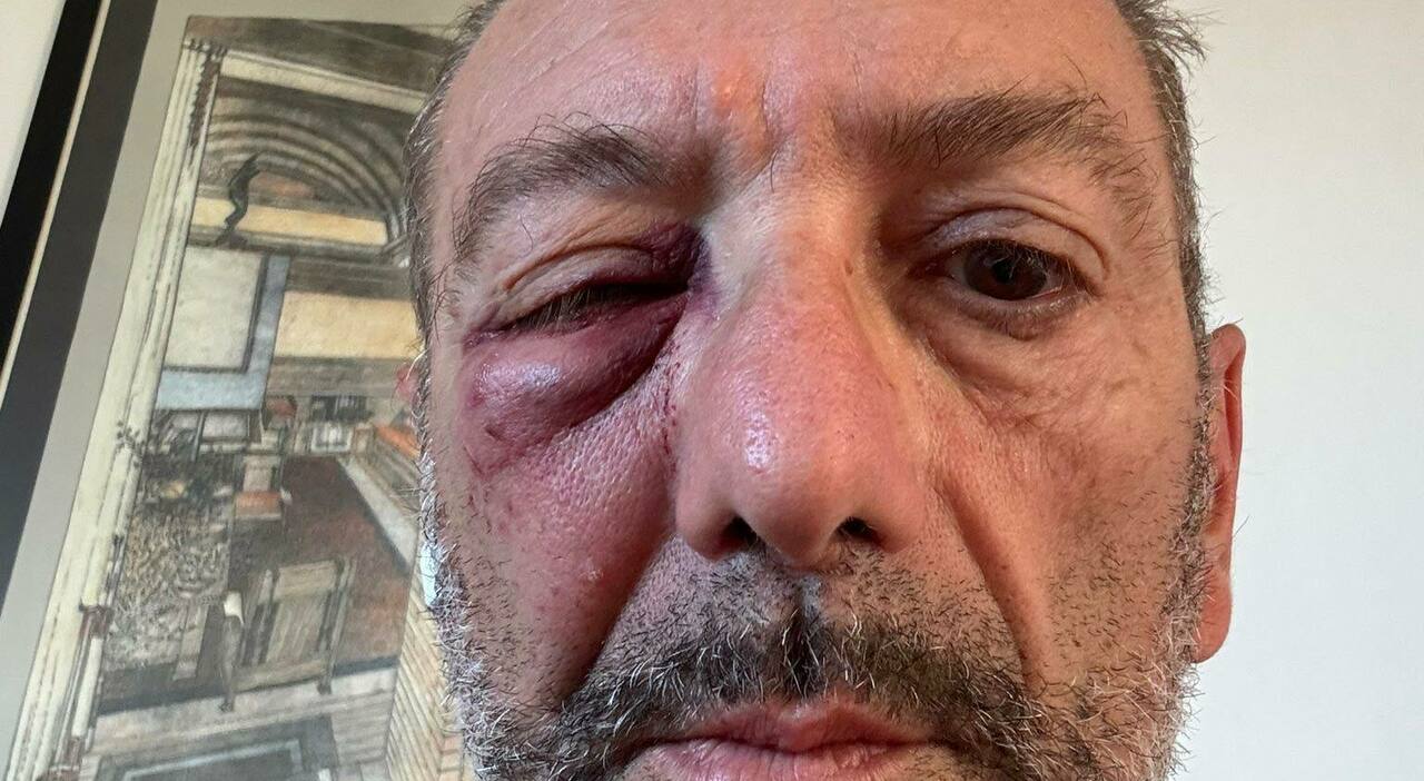 Choc a Bari, runner colpito da un uovo: è in ospedale. Il lancio da un Choc a Bari, runner colpito da un uovo: è in ospedale. Il lancio da un
