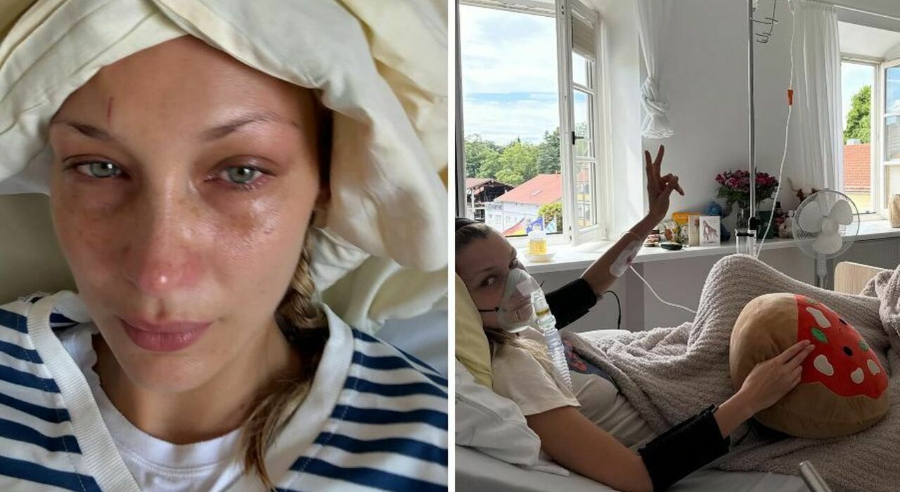 Bella Hadid in ospedale, le foto preoccupano i fan: «Scusate se sparisco sempre». Come sta la modella Bella Hadid in ospedale, le foto preoccupano i fan: «Scusate se sparisco sempre». Come sta la modella