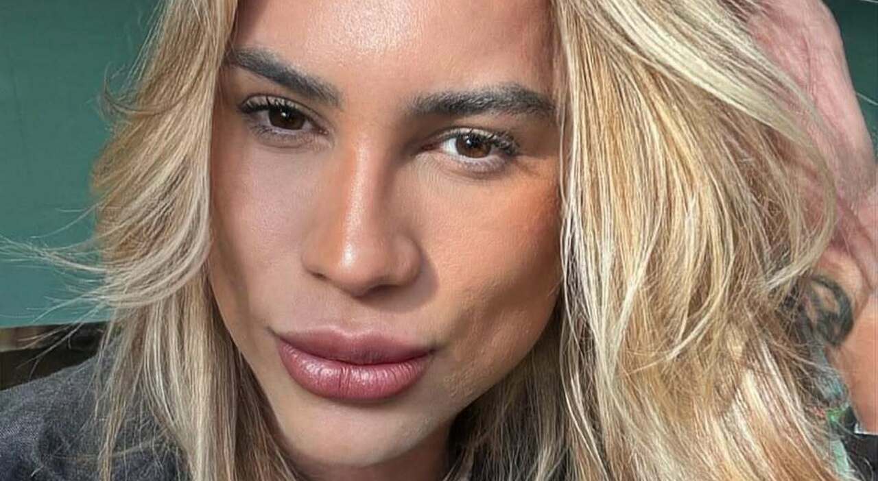 https://statics.cedscdn.it/photos/MED_HIGH/2025/10/08/9114731_08152245_influencer_morto_intervento_chirurgia_estetica_fox_eye_adair_mendes_dutra_junior_oggi_8_ottobre_2025.jpg