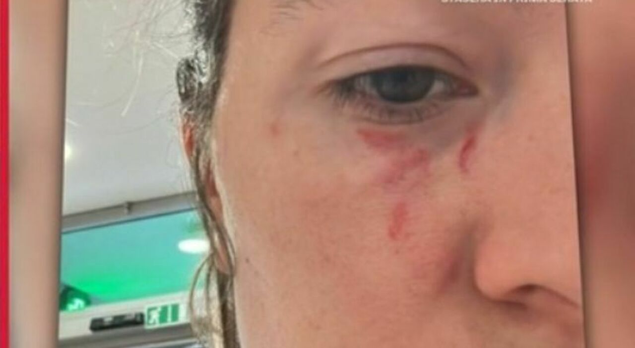 pamela genini la foto dei lividi inviata all amica 8 mesi fa gianluca soncin le punt242 anche una pistola contro perch233 nessuno l ha fermato