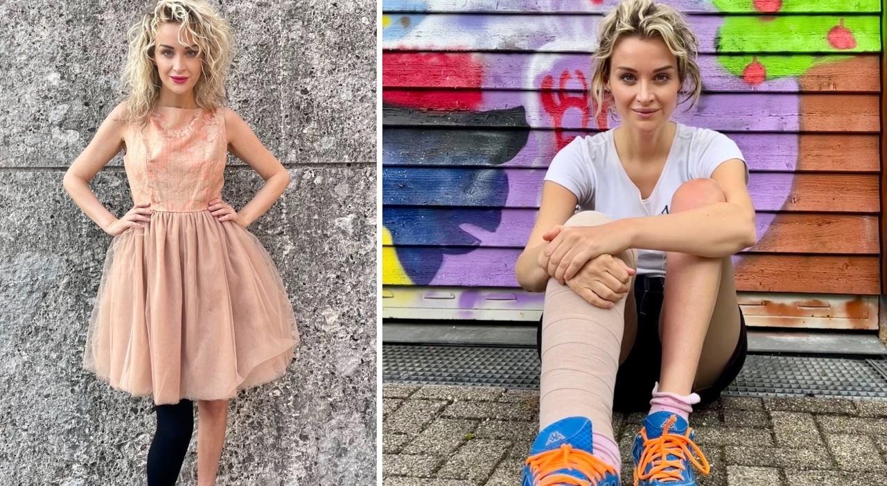 «Pensavo fosse un brufolo, era un melanoma. Da 15 anni convivo con il linfedema, mi sono nascosta e vergognata. Oggi sono una modella e la mia gamba è un simbolo» «Pensavo fosse un brufolo, era un melanoma. Da 15 anni convivo con il linfedema, mi sono nascosta e vergognata. Oggi sono una modella e la mia gamba è un simbolo»