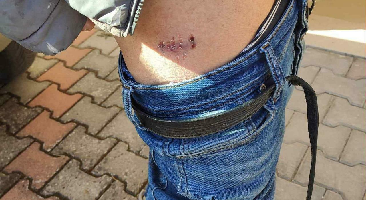 paura a ostra vetere lalano colpisce ancora azzannato un residente 232 il terzo in due mesi da Corriereadriatico.it paura a ostra vetere lalano colpisce ancora azzannato un residente 232 il terzo in due mesi