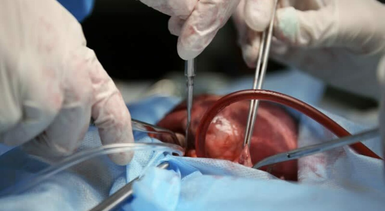 Il Policlinico di Bari è il primo ospedale in Europa per trapianti di cuore. Superato anche l Il Policlinico di Bari è il primo ospedale in Europa per trapianti di cuore. Superato anche l