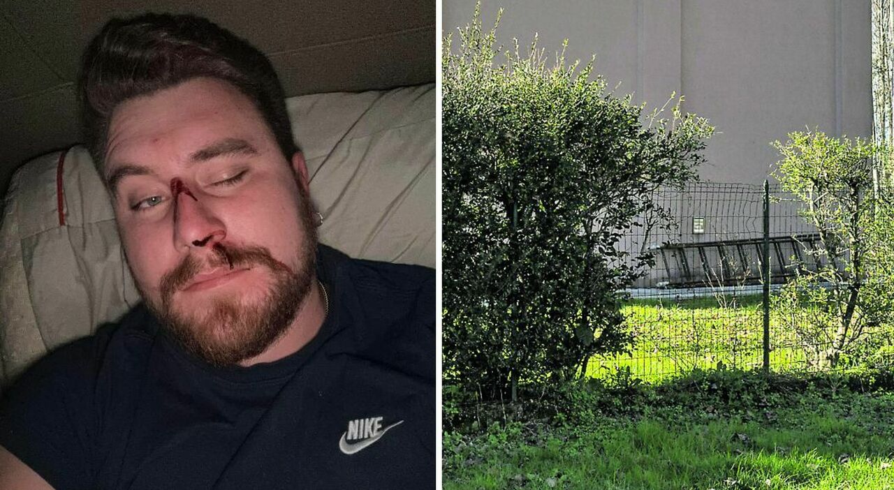 Ladri in casa, Andrea Bessegato li sorprende in giardino e viene preso a bastonate in faccia: «La terza volta in un anno che provano a derubarmi» Ladri in casa, Andrea Bessegato li sorprende in giardino e viene preso a bastonate in faccia: «La terza volta in un anno che provano a derubarmi»