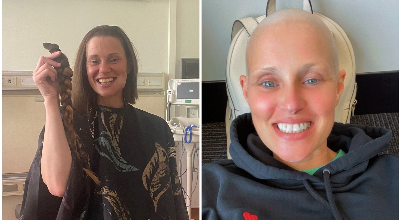 Mandibola gonfia e mal di denti, la diagnosi errata dei medici: «È un ascesso». Mamma di 39 anni scopre un tumore rarissimo grazie a un