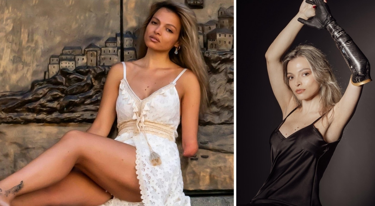 «Nata senza mano e avambraccio sinistro, mi dicevano "peccato che non lavorerai, sei una bella ragazza". Invece ho portato la disabilità a Miss Italia»