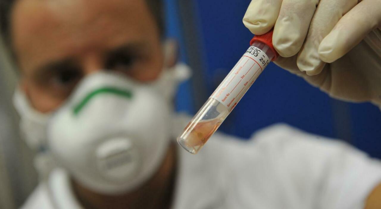 Influenza, quanto dura, quali sono i sintomi e chi rischia di più. Bassetti: ?«Il virus può colpire tutti gli organi» Influenza, quanto dura, quali sono i sintomi e chi rischia di più. Bassetti: ?«Il virus può colpire tutti gli organi»