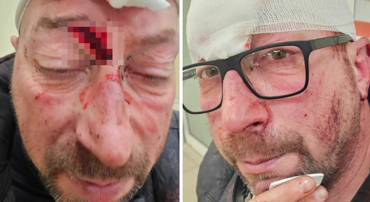 ivan panizzolo aggredito fuori dal bar canova io soffocato e colpito con il piede di porco pensavo di morire non conoscevo quel giovane