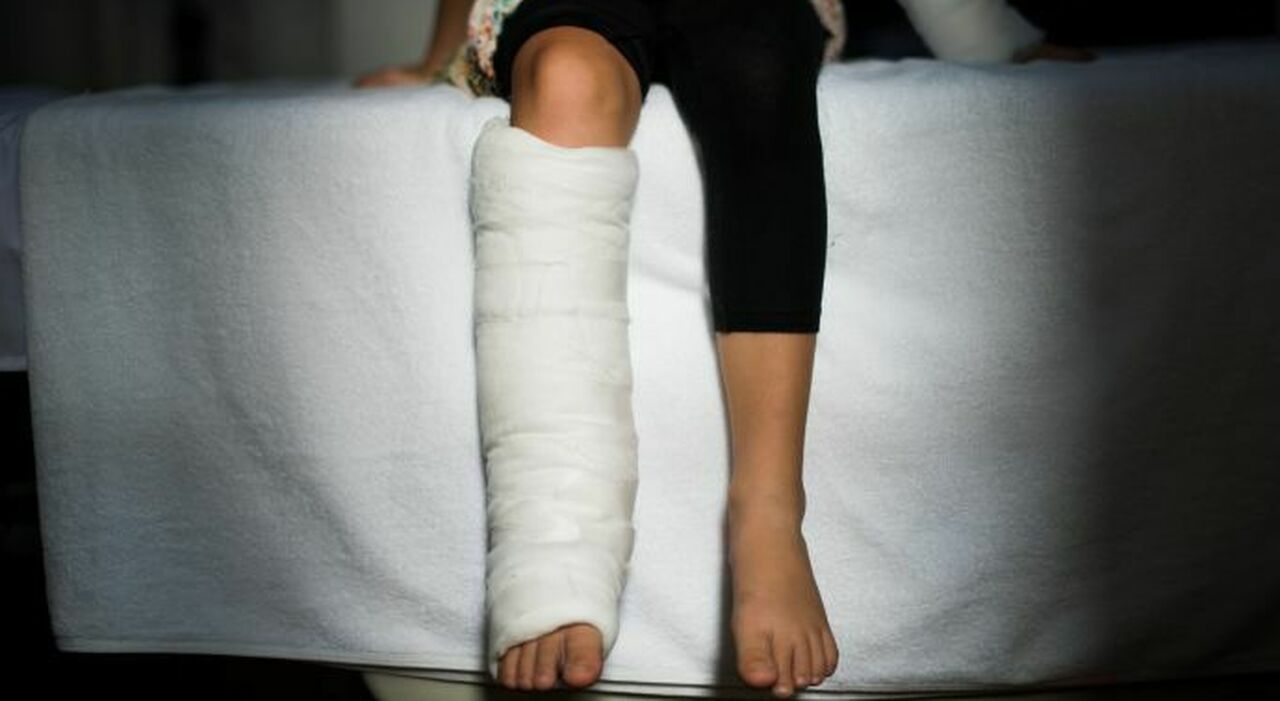 Ospita la mamma della fidanzata nel suo b&b, lei cade e si frattura la caviglia: ora dovrà risarcirla con 25mila euro