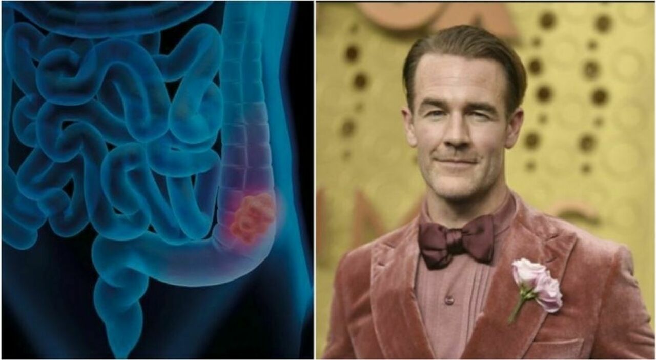 https://statics.cedscdn.it/photos/MED_HIGH/2026/02/11/9353740_11204245_james_van_der_beek_dawson_come_e_morto_malattia_cancro_colon_retto.jpg