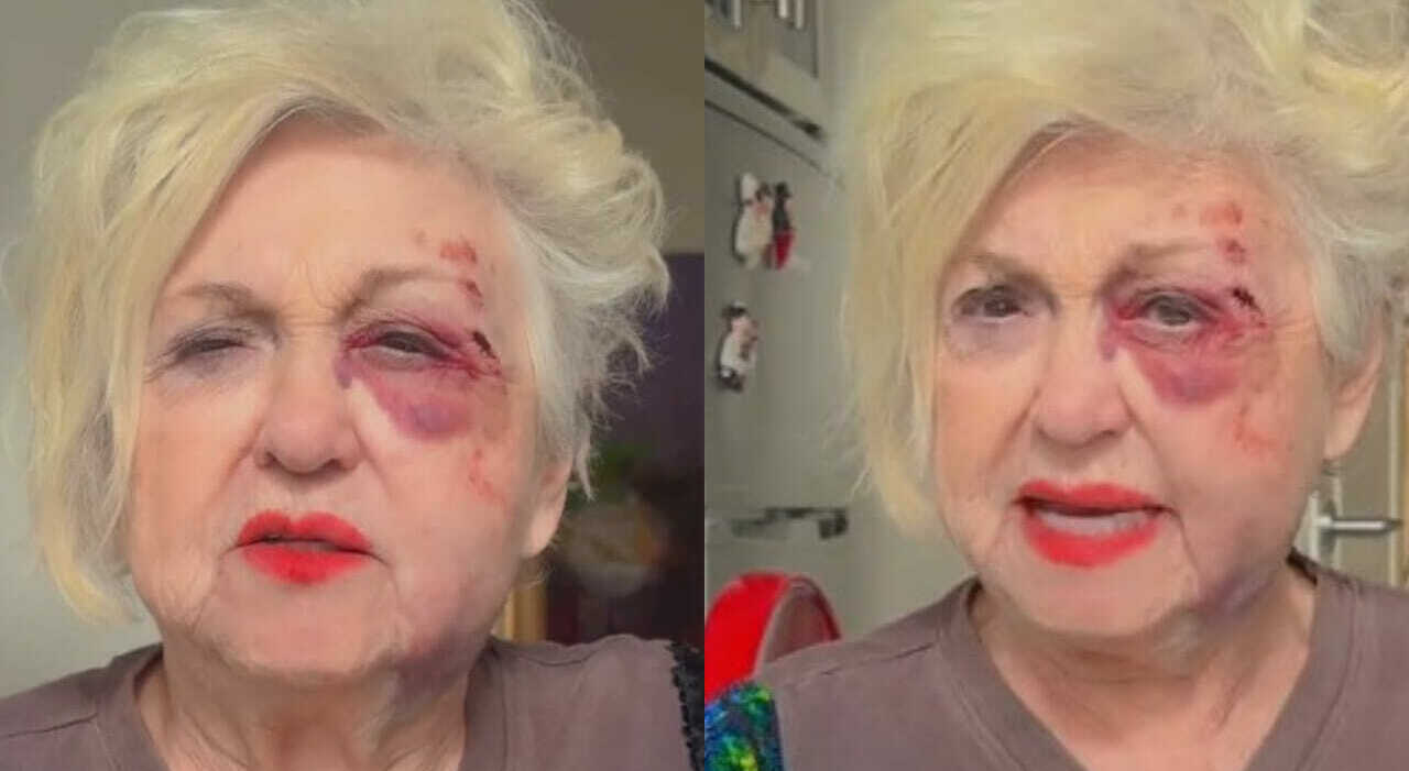 Wanna Marchi Investita Da Un auto Sulle Strisce Pedonali A Milano Una Wanna Marchi Investita Da Un auto Sulle Strisce Pedonali A Milano Una