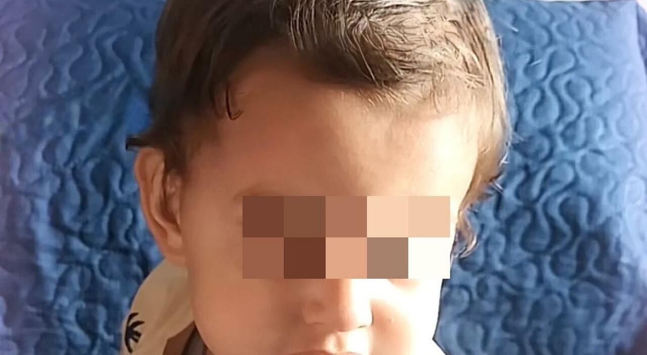 Trapianto fallito al Monaldi: «Domenico, situazione sempre più critica. Rapido peggioramento» Trapianto fallito al Monaldi: «Domenico, situazione sempre più critica. Rapido peggioramento»