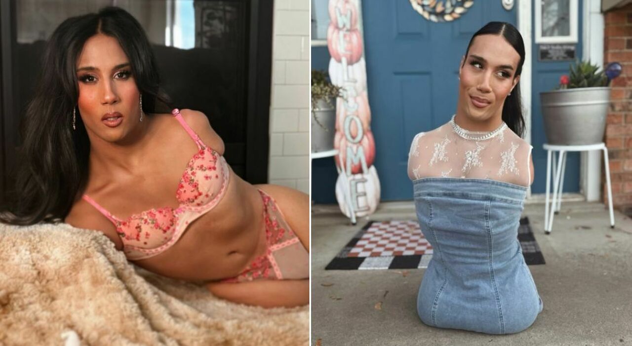https://statics.cedscdn.it/photos/MED_HIGH/2026/03/24/9435392_24113804_briel_adams_wheatley_influencer_transgender_senza_braccia_gambe_tiktok.jpg