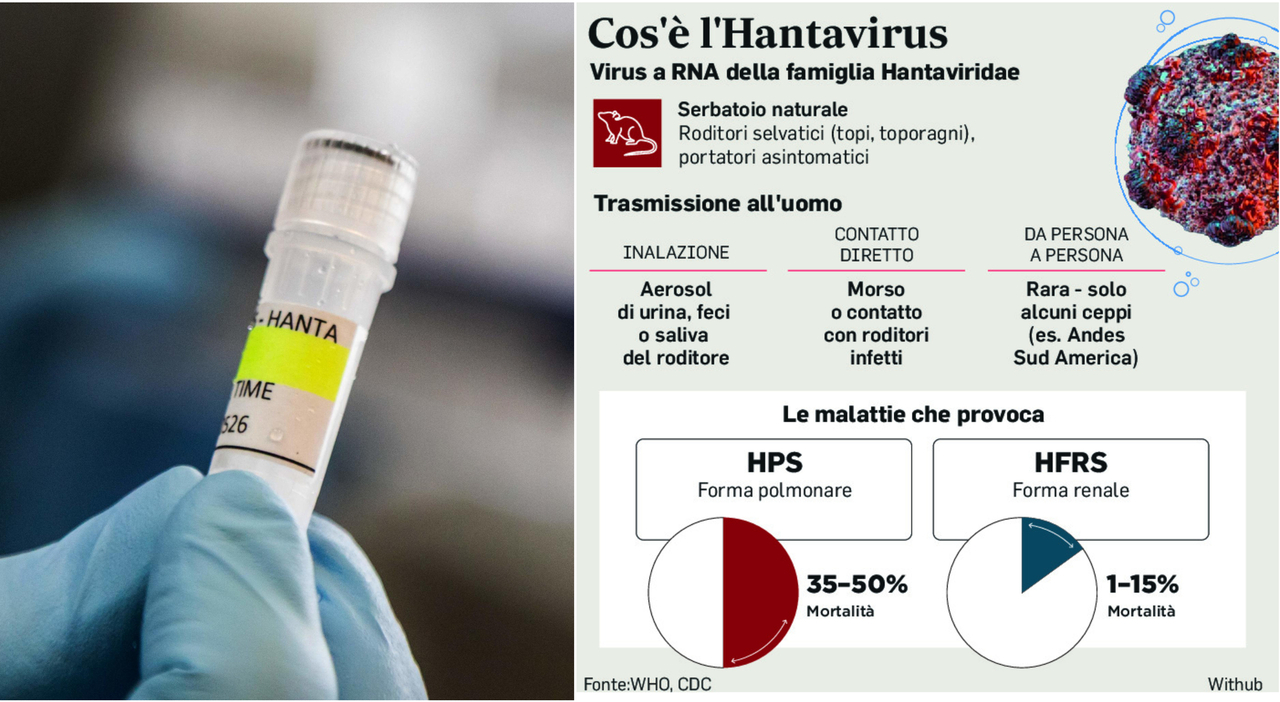 hantavirus in italia esiste davvero un rischio come si prende quali i sintomi e cosa fare se si viaggia ecco cosa sapere