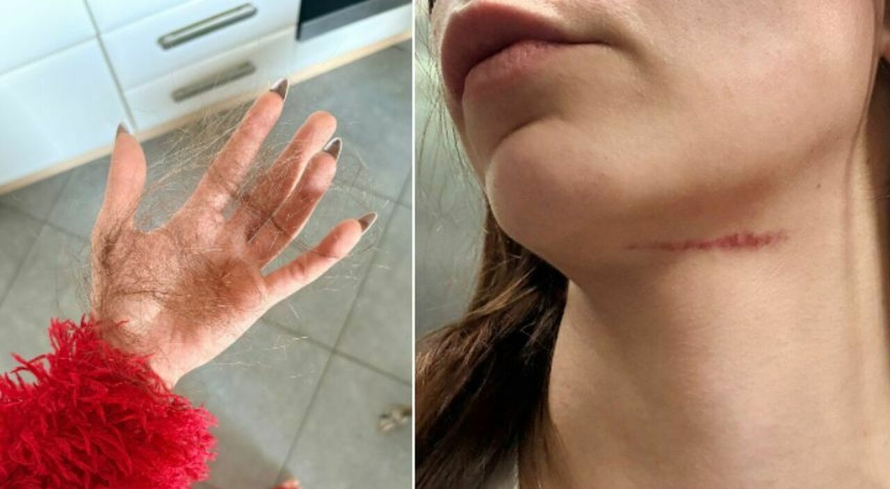 io aggredita dagli ultras del venezia sul vaporetto presa per il collo e a pugni in faccia poi inseguita con il mio fidanzato