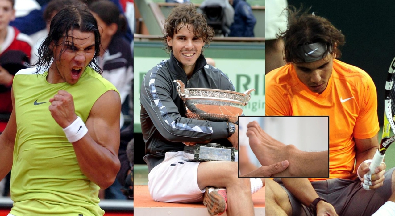 nadal una carriera contro il tempo la malattia congenita sindrome di m252ller weiss il plantare speciale e il rapporto con lo zio toni da Ilmessaggero.it nadal una carriera contro il tempo la malattia congenita sindrome di m252ller weiss il plantare speciale e il rapporto con lo zio toni