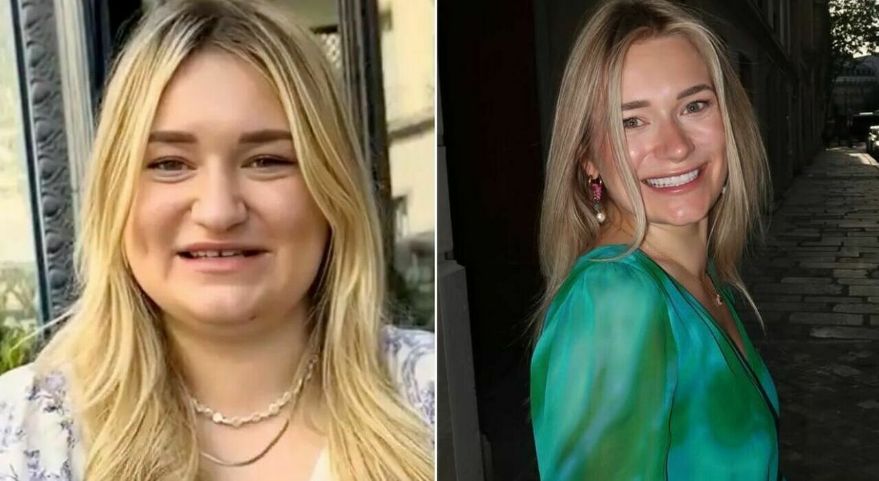 https://statics.cedscdn.it/photos/MED_HIGH/2026/06/12/9588386_12133159_prima_dopo_chirurgia_plastica_dieta_sashawithlove_glow_up.jpg