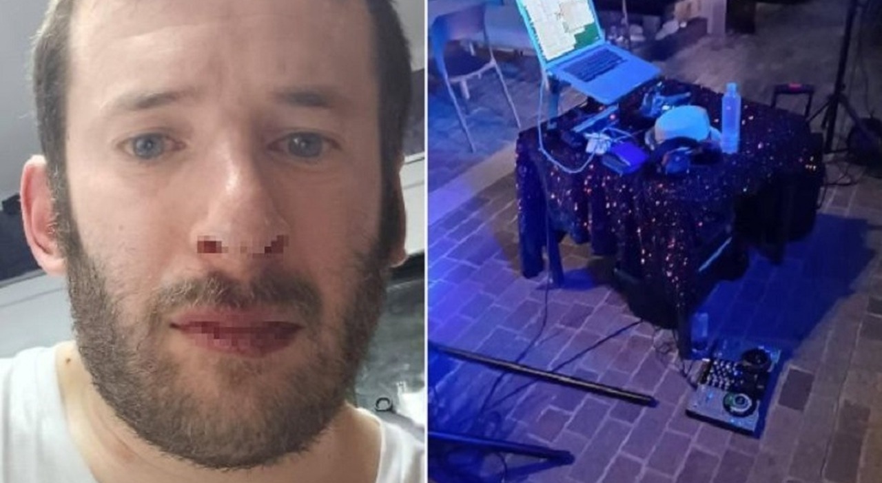 flavio lacagnina dj picchiato sabato sar242 a lavoro ma avr242 lo spray ho un forte calo delludito mi sono fatto visitare in ospedale da Ilgazzettino.it flavio lacagnina dj picchiato sabato sar242 a lavoro ma avr242 lo spray ho un forte calo delludito mi sono fatto visitare in ospedale