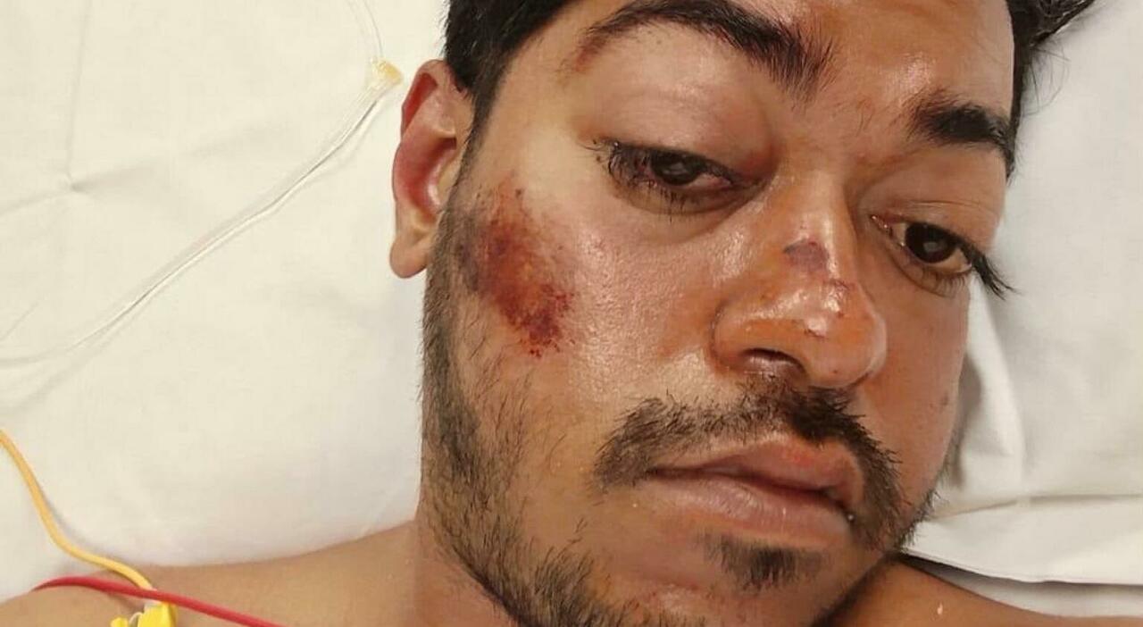 rakeb kashem morto dopo il pestaggio ma lautopsia il fegato ko per colpa di cocaina e alcol da Ilgazzettino.it rakeb kashem morto dopo il pestaggio ma lautopsia il fegato ko per colpa di cocaina e alcol