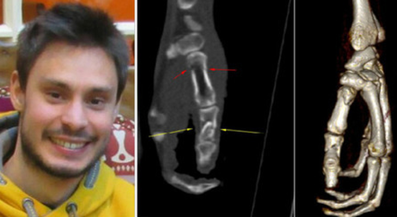 https://statics.cedscdn.it/photos/MED_HIGH/2026/06/24/9611848_24150537_giulio_regeni_risarcimento_quanto_egitto_agenti_segreti_famiglia.jpg