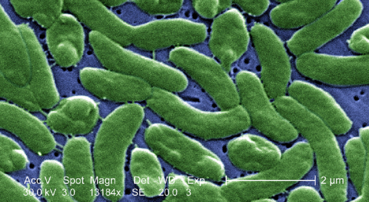 https://statics.cedscdn.it/photos/MED_HIGH/2026/07/03/9629793_03115123_vibrio_vulnificus_01.jpg