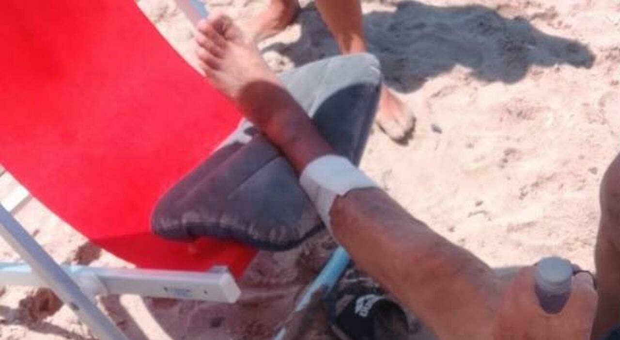 turisti morsi a sangue dai pesci in cilento allarme tra i bagnanti 232 successo a palinuro e a pioppi da Ilmattino.it turisti morsi a sangue dai pesci in cilento allarme tra i bagnanti 232 successo a palinuro e a pioppi