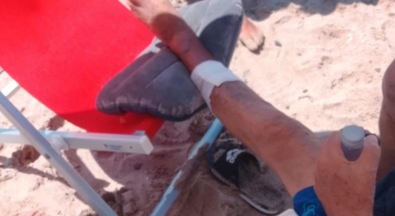 morsi di pesce nel cilento lesperto rassicura ecco il motivo ma nessun allarme il mare resta sicuro da Ilmattino.it morsi di pesce nel cilento lesperto rassicura ecco il motivo ma nessun allarme il mare resta sicuro