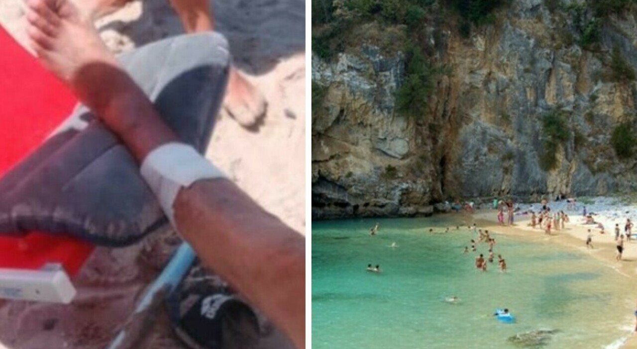 https://statics.cedscdn.it/photos/MED_HIGH/2026/07/24/9670316_24134113_turisti_morsi_cilento_quali_pesci_ipotesi_cosa_sappiamo.jpg