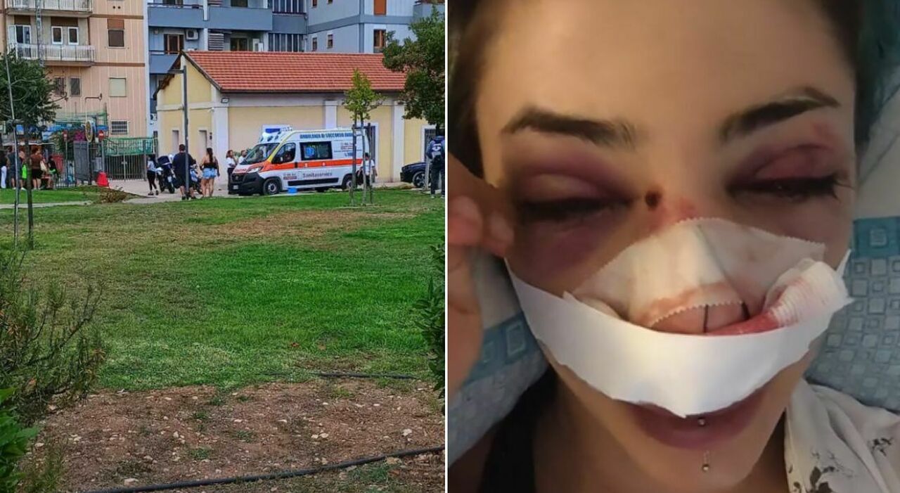 https://statics.cedscdn.it/photos/MED_HIGH/2026/07/24/9670797_24211403_ragazza_picchiata_a_bari_parco_rossini_video_giuditta_come_sta.jpg