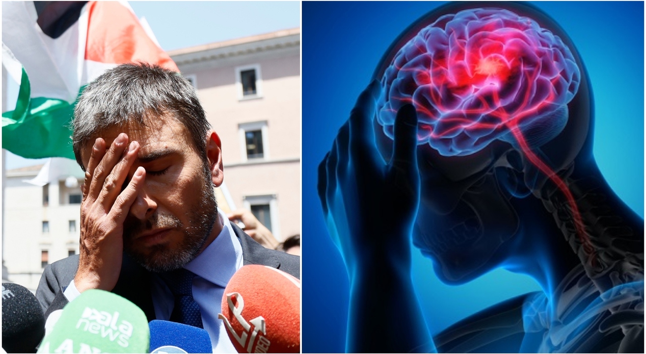 di battista e i forti dolori alla testa la neurologa ecco le possibili cause sintomi e quando la cefalea deve preoccupare da Ilmessaggero.it di battista e i forti dolori alla testa la neurologa ecco le possibili cause sintomi e quando la cefalea deve preoccupare