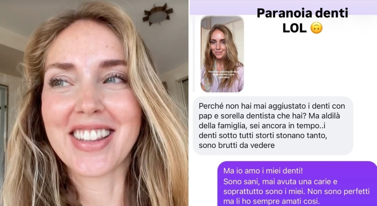 https://statics.cedscdn.it/photos/MED_HIGH/2026/09/02/9739414_02172339_chiara_ferragni_denti.jpg